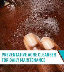 Acne Control Cleanser