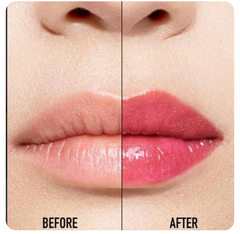 DR INTENSE ROSE 037