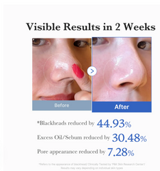 Zero Pore Pads