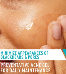 Acne Control Gel